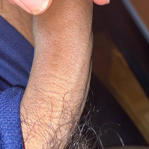 Foto extra 1